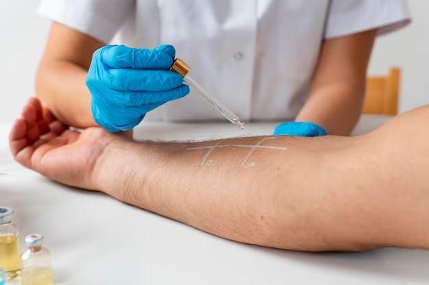 Vein Treatment for Varicose